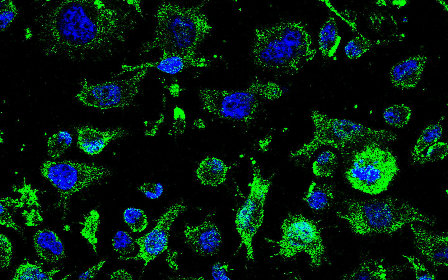 Fluorescence microscopy cells in ALS research by Molefy Pharma